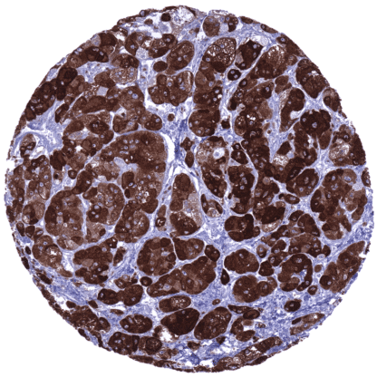 [sk1610] Inhibin Alpha (MSVA-561R)