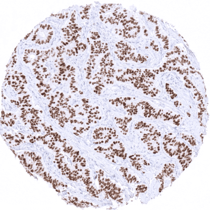 [sk1612] INSM1 (MSVA-456R)