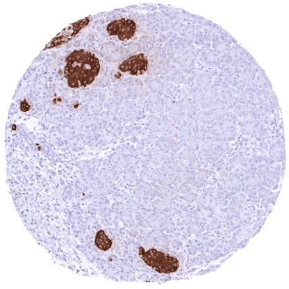 [sk1616] Insulin (HMV308)