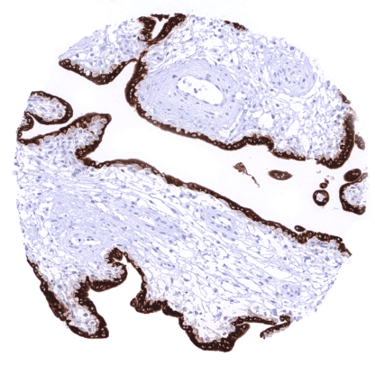 [sk1625] Kiss1 (HMV3972)