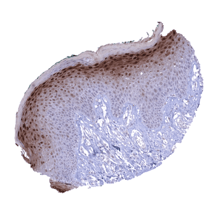 [sk1428] Cystatin A (MSVA-461M)